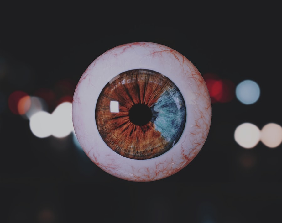 Set Vision
